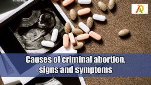 criminal-abortion