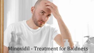 baldness-treatment
