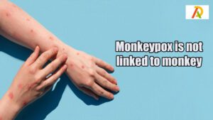 monkeypox